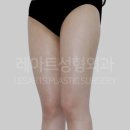 레아트성형외과의원 이미지