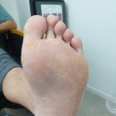 더발라네일