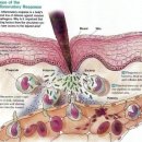 37.5℃ 트레이닝 센터 | [부산 재활/ 스포츠재활] 서면 재활센터에서 야구선수 포수 토미존 수술 후 재활 가동범위 ROM