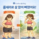 쿨한의원 이미지