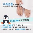 수족발 이미지