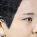 압구정스타일의원 네이버블로그