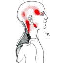 [일우] 상부승모근(Upper Trapezius) 이미지