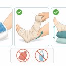 발목 접질렀을 때 대처법 이미지