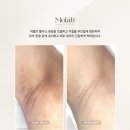미랩 | 유륜미백, 관리하고 싶다면? 미랩 멜라닌 케어 사용 후기
