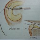 관절내시경-관절내시경의 장점 및 관절내시경 수술 후 관리법 이미지