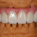 리더스치과기공소 이미지