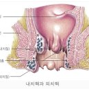 칫일은 완치될 수 있다! 나의 칫일 치유기 이미지