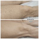판교왁싱&피부 리메이크 이미지