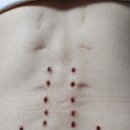 허리 아프신 분 보세요 이미지