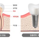 재생플란트치과의원 이미지