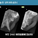 해든덴탈 이미지