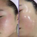 전주피부샵 피부관리 받고 얼굴광 제대로 올린 현피부샵 후기