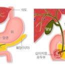 1탄-네? 십이지장암이요? 아.. 망했다... 우리엄마 어쩌지...? (암환자 보호자용 -스압주의) 이미지