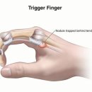 오성수지 이미지