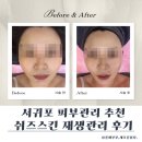 서귀포 피부관리 쉬즈스킨 재생관리 후기