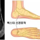 발바닥 가운데 통증 원인 알아봐요 이미지