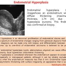 Endometrial Hyperplasia 이미지