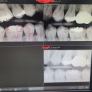 문치과병원 | 천안 단국대 치과병원 후기