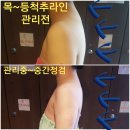 승바른체형 이미지
