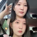 수올 | 수원 피부과 볼패임없는 올타이트리프팅 후기 (32살 기념 600샷···)