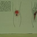 베이커 낭종(Baker's cyst) 이미지