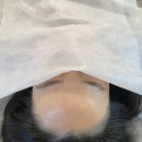 류헤어라인 이미지