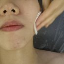 미인케어 송파거여점 | 송파 위례피부관리 여기 추천 트러블 케어 대만족 에스테티아 송파거여1호점