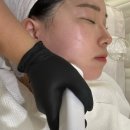 기미 잡티 미백에 효과좋은 피부관리 하단플라즈마 [하단빛나스킨룸]