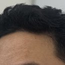 모디헤어플란트의원 이미지