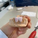중앙치과기공소 | [세미나 후기] 빌트기공소 빌드업강좌 (Day 5,6)