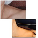 우람동물병원 | 승모근 보톡스 창원피부과에서 4개월 주기로 2회차 맞은 리얼후기