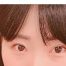 토니모리인천구월동점 | (인천/구월동)쌍수 완전절개 + 앞트임 경과 후기 모음