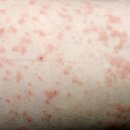 조생한의원 이미지