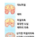 ApoE 유전자 : 치매와 알츠하이머병, 혼동하지 마세요! 신경과 전문의가 알려주는 진단과 치료법