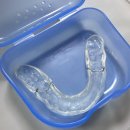 턱관절 통증 치과에서 스플린트 맞춘 후기 내돈내산