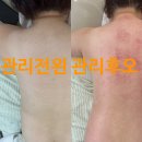 여우체형관리 | 이천피부관리/마장도도한여우 테라노바 등관리 후기