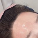 무지개헤어라인 | 답십리 헤어라인 이마 왁싱 후기, 얼태기에 추천하는 이유, 아르떼속눈썹브로우