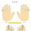 뜸