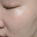 미소케어 | 스킨미소 퓨어비타민C세럼 잡티 미백케어 후기