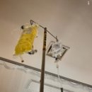 만성염증 치료 방법 후기 (주사 약 음식 영양제)