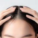 드림헤어라인의원 네이버블로그