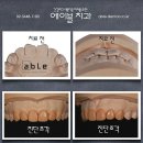 에이블치과기공소 이미지