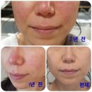 몸살림요가 이미지