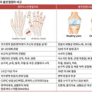 투엑스비콘드로800 vs 오메가3 이미지