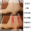 루나스킨