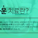 늘편한치과의원 네이버블로그