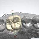 하늘치과기공소 이미지
