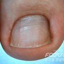 올케어 강남 이미지