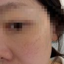 아진토탈케어 | 도봉구 쌍문방학 피부관리샵 추천 이음메디컬스킨 기미잡티케어